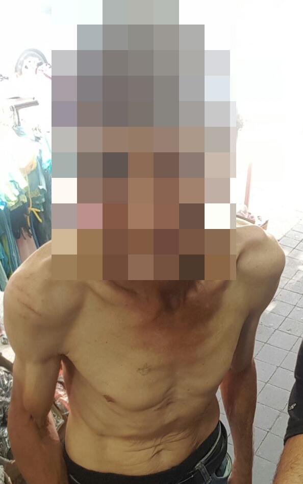 ד', כחוש מאוד, מקבל רגע של חסד שהוא מגיע לבית החולים (צילום מתנדבים)